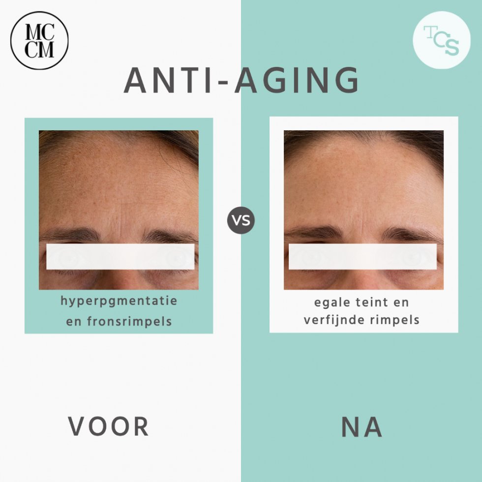 Anti-aging