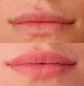 Aquarel lips zachte gezonde gloed lip TCS